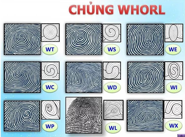 Chủng vân tay Whorl